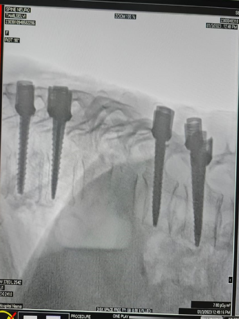 SLIMS Ortho Surgery